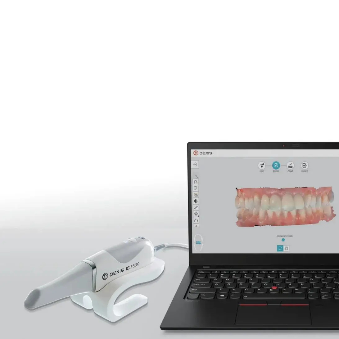 2025 NUOVO DEXIS IS 3600 Scanner intraorale impressionista digitale Trasferimento dati aperto per protesi, impianti, ortodonzia