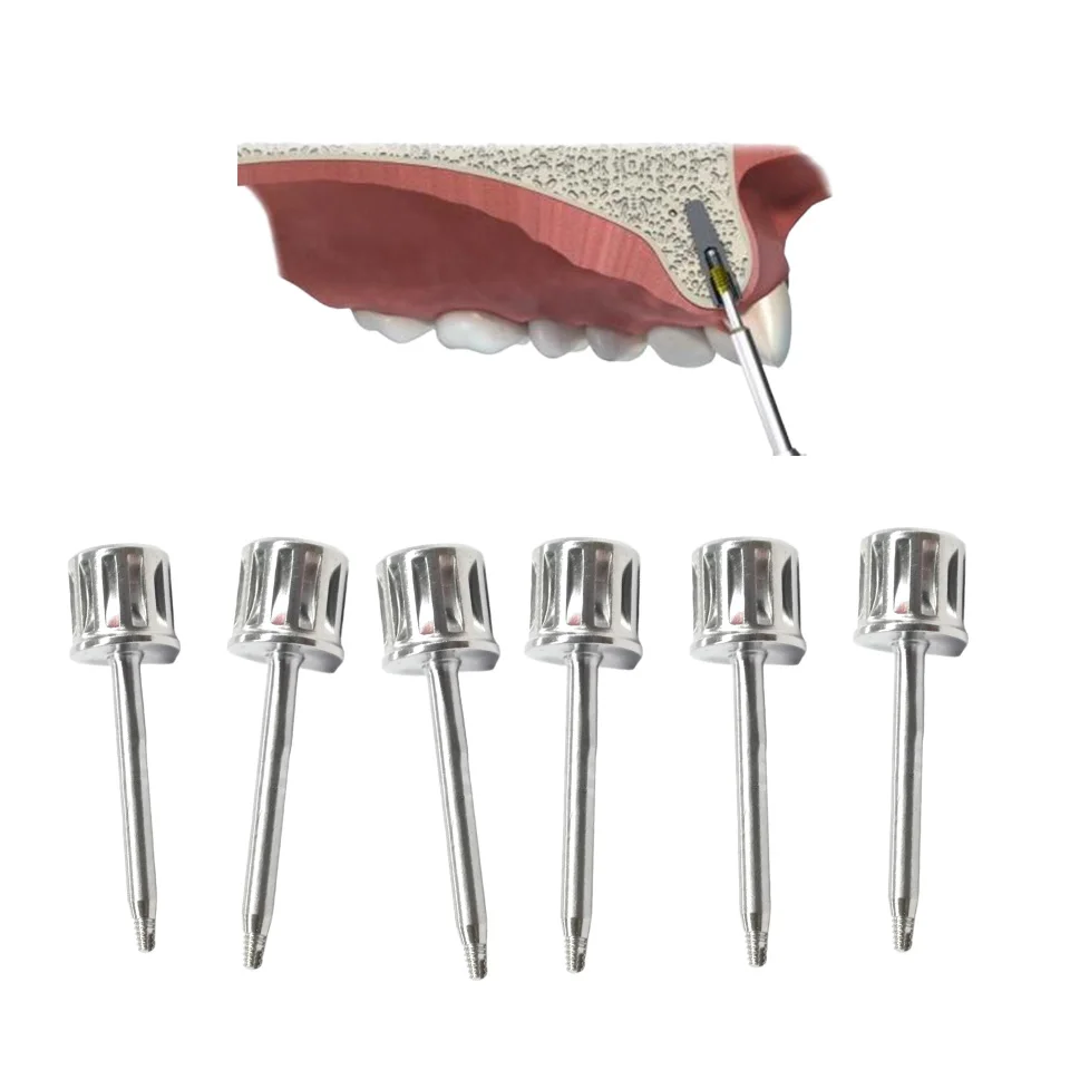 Dental Implant Broken Screw Extractor Fits Multi-Brand Damaged Abutment Screw Remover Reverse Tap Manual Hand Driver Tools Parts