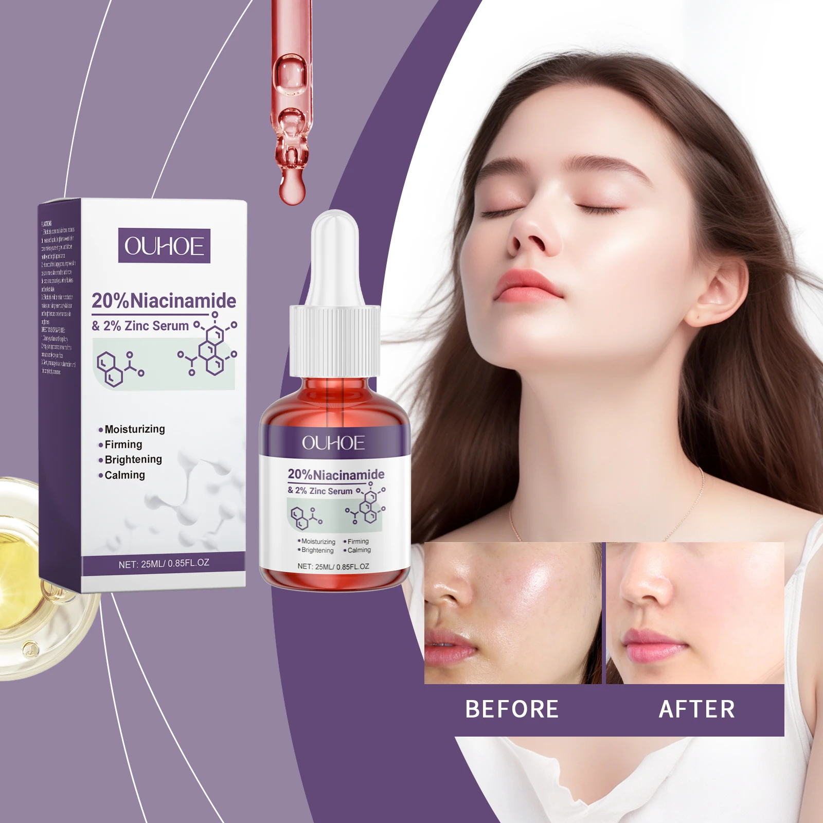 

OUHOE Niacinamide Zinc Serum - Even Skin Tone, Shrink Pores, Deep Moisturize, Anti - acne, All - round Skin Glow
