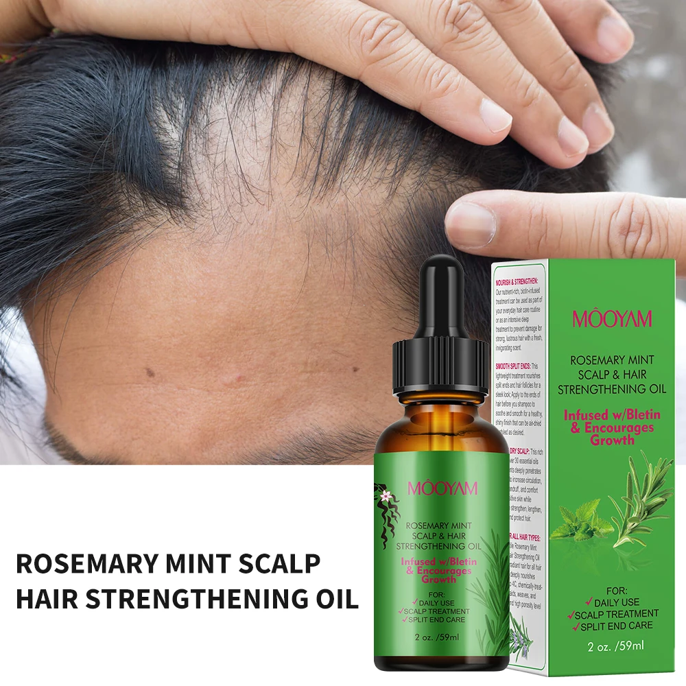 

59ml Handmade Rosemary Essential Oil Pure Natural Dry Organics and Split Ends Hair for Hair Growth