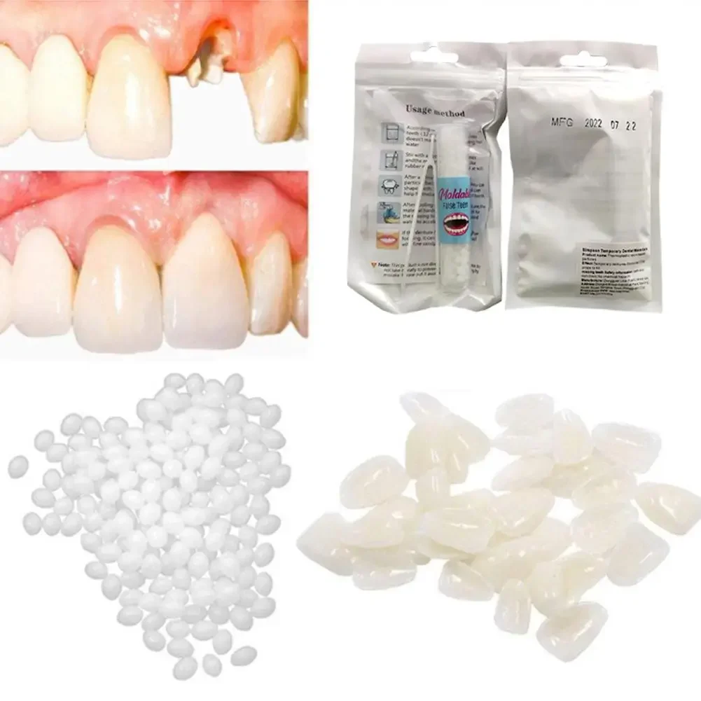 5g/10g/15g/20g Temporary Tooth Repair Kit Teeth And False Teeth Adhesive To Whitening Glue Tooth Gaps Solid Beauty Teeth De M7V0