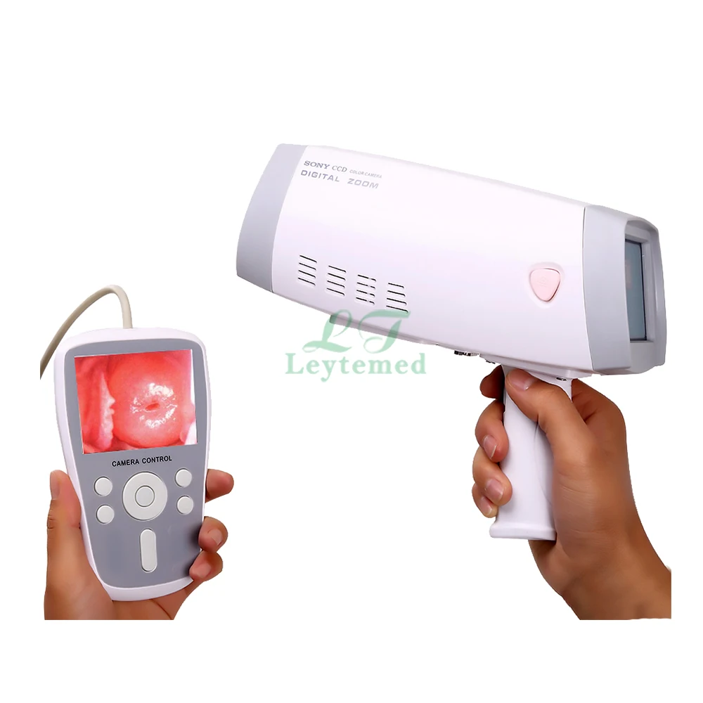 LTEC01 Populaire Handheld Mini Video Vagina Onderzoek Colposcoop