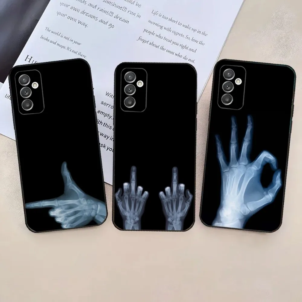 

X-RAY Radiological Skeleton Phone Case For Samsung Galaxy A20,A21s,A22,A31,A32,A52,A53,A72,73,A80,A91 Soft Black Phone Cover