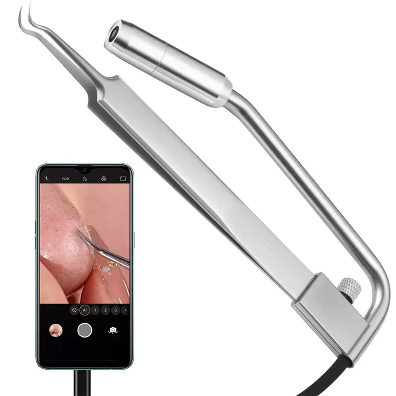 Per strumento viso Rimozione testa nera Fotocamera professionale popper per brufoli HD, ingrandimento 30 volte 1080P