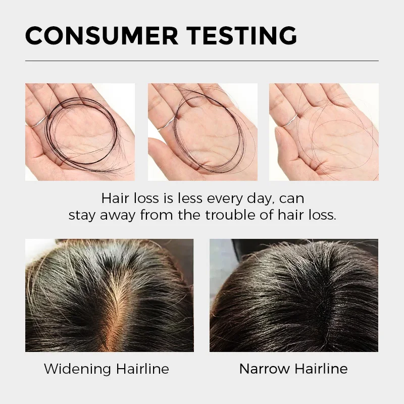 아미노산 샴푸 – 탈모 방지, 모발 강화, 딥 클렌징, 두피 케어, 모근 강화 및 유분 조절