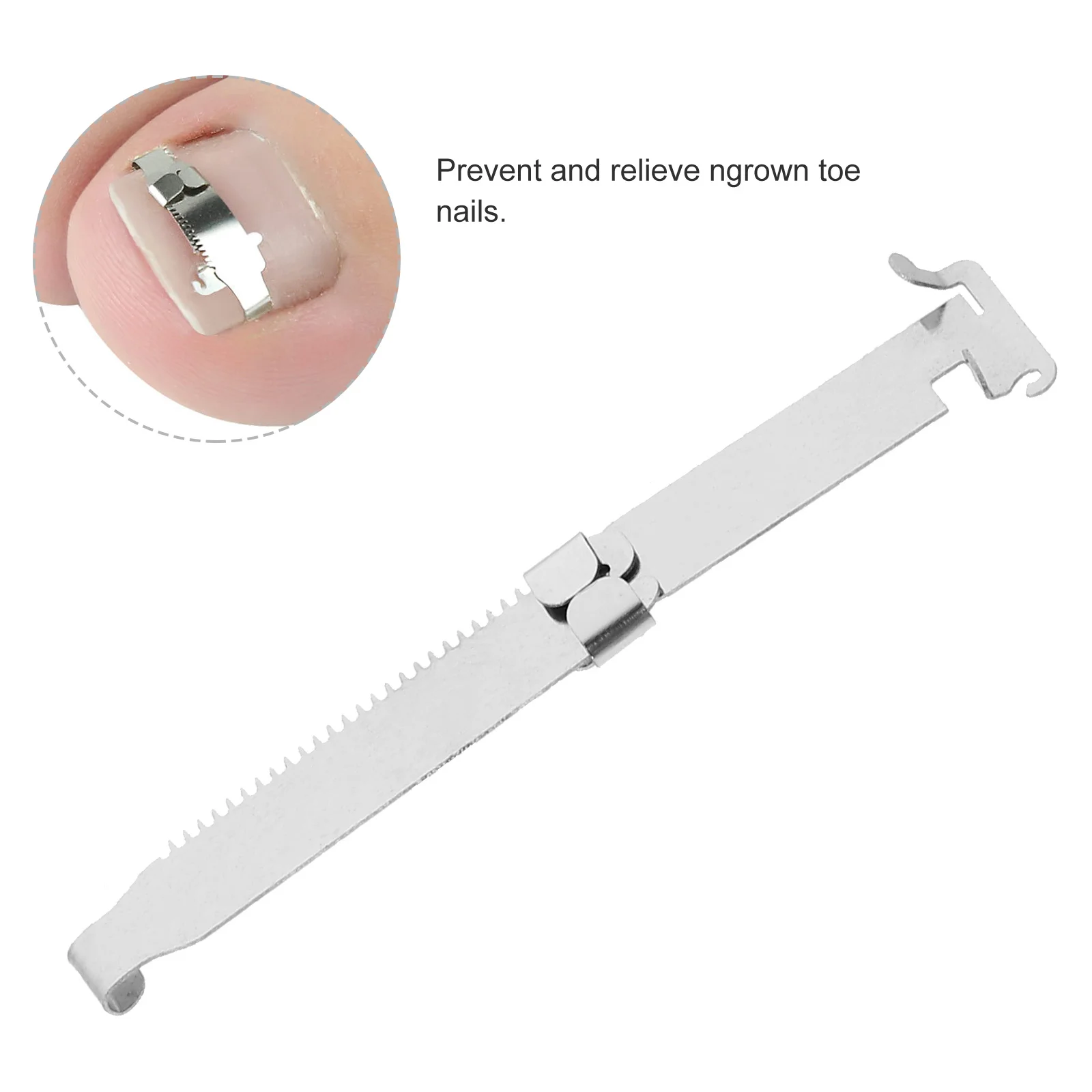 Corrector Tool Toenail Braces Tools Toenails Correction Buckles Clip Repair Orthotics