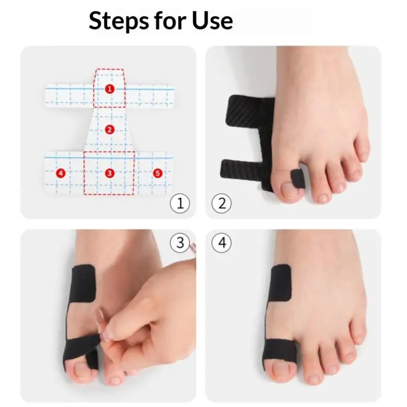 10 Stück hypoallergenes, latexfreies, vorgeschnittenes Kinesiologie-Tape zur Korrektur von Hallux valgus und zur Schmerzlinderung bei den großen Zehen. – Detail 10