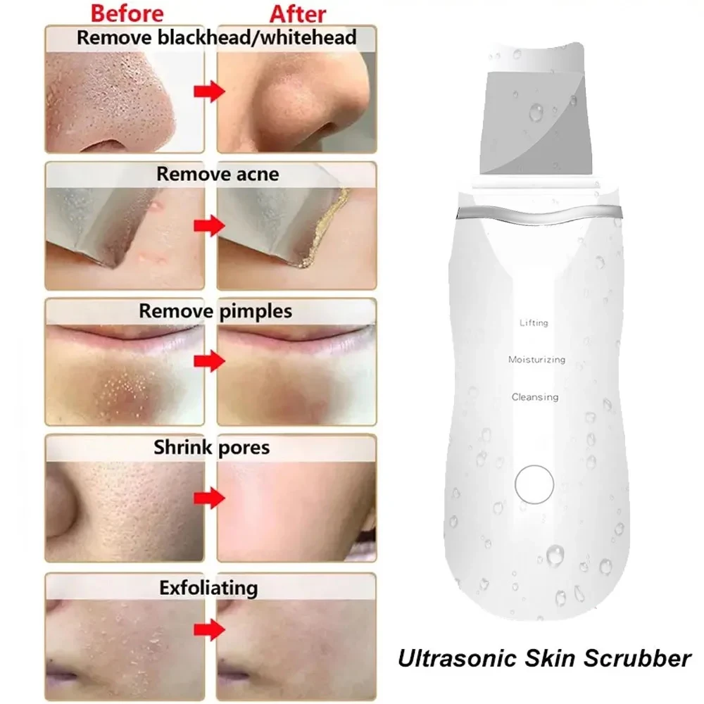 Ultrasonic Skin Scrubber Peeling Blackhead Remover Deep Face Cleaning Skin Scrubber Acne Pore Cleaner Facial Shovel Cleanser