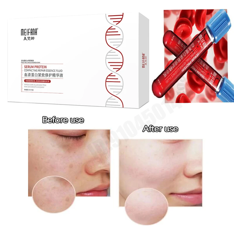 

Салон красоты Коллагеновая сыворотка для лица против морщин Fade Fine Lines Увлажняющее средство для лица Освещение против старения Укрепляющее эссенционное масло