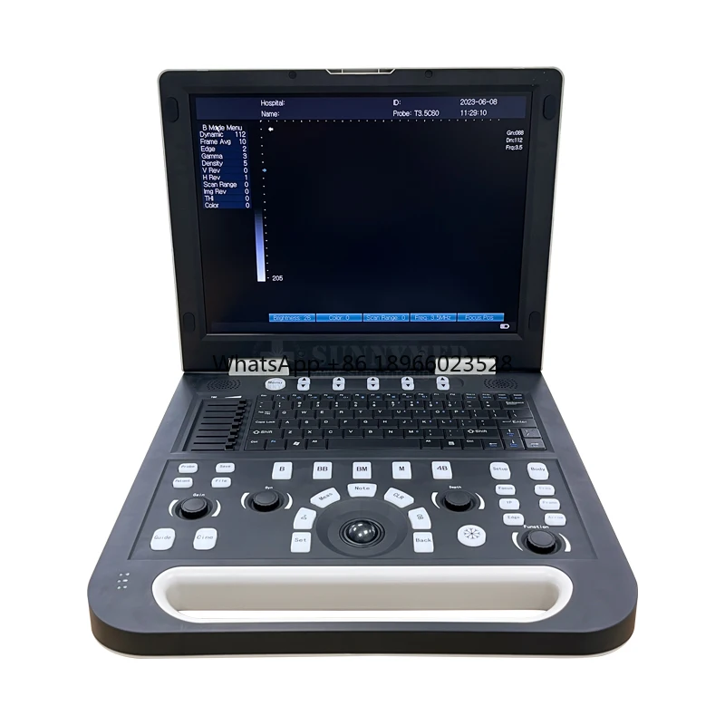 SY-AN50 Accurate Black and White Portable Medical Ultrasound Machine