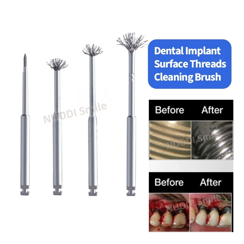 

1 шт. стоматологическая титановая щетка для очистки поверхности при периимплантите, для дебридемента при восстановлении и уходе за имплантатами, автоклавируемая