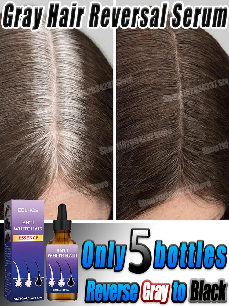 88 بيع الشعر المضاد للرمادي الأبيض إلى الأسود اللون الطبيعي إصلاح تغذية مكافحة فقدان الرعاية للرجال والنساء