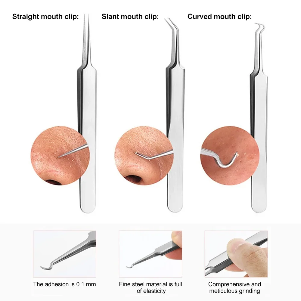1 Stück Fein Nr. 5-Zellular-Akne-Mitesser-Pinzette, Zellen-Pickel, Mitesser-Clip, Gesichtsschönheit, Entfernung von Akne-Nadel-Werkzeugen für die Hautpflege