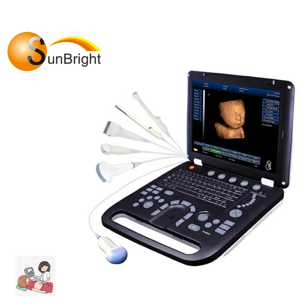 ecografo portatil en color doppler de escaner portable  ultrasonido   4d bajo precio