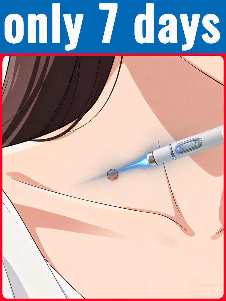 ثآليل مطورة من الجيل الثاني جذر الثآليل الإصلاح غير المؤلم بسرعة #1