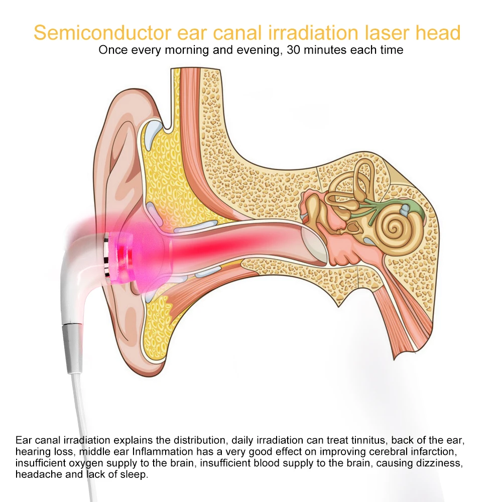 Máquina de terapia láser de 650nm, máquina de rinitis Sinusitis, cuidado de la nariz, bionasa Tinnitus, terapia láser de oído, irradiación LLLT,