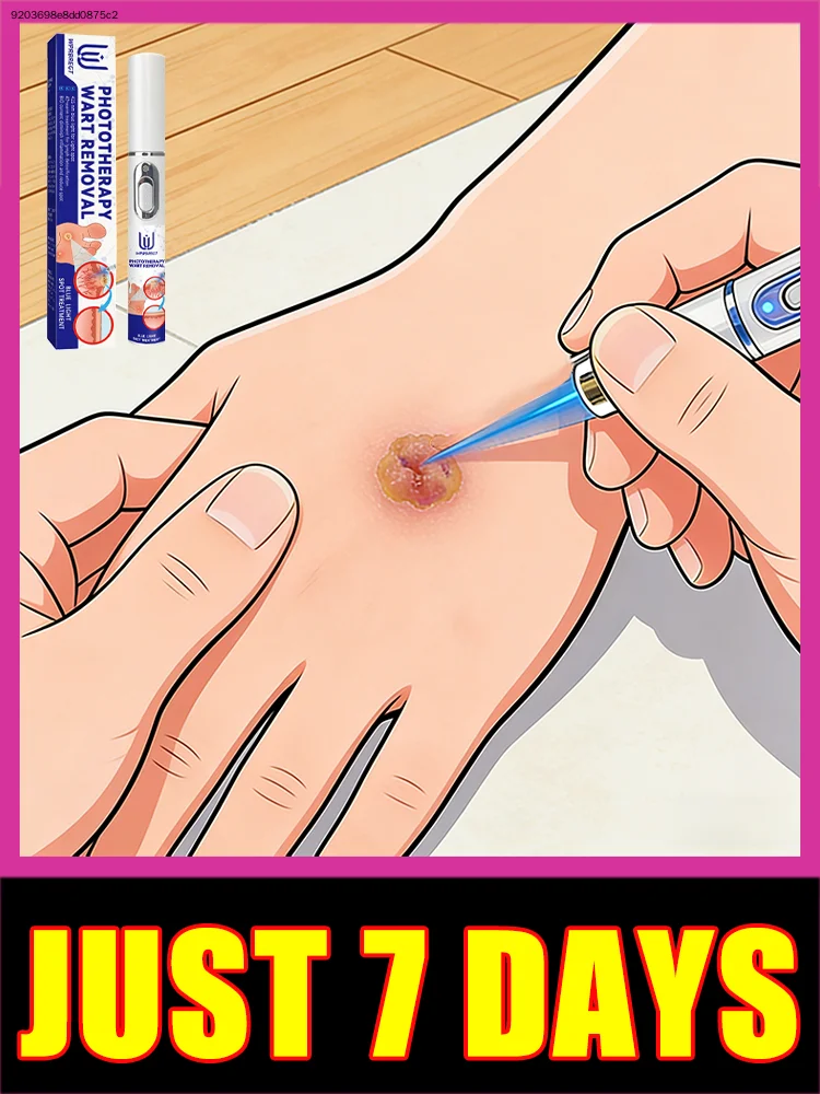 

Wart Removal Pen for Home Daily Use Low Power Portable Physical Skin Tag Cleansing Tool