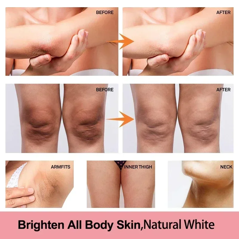 Vitamin C Brighten Cream Bleaching Armpits Elbows Knees Moisturizing Body Lotion Cream Brightening Skin Cream Lightening Melanin