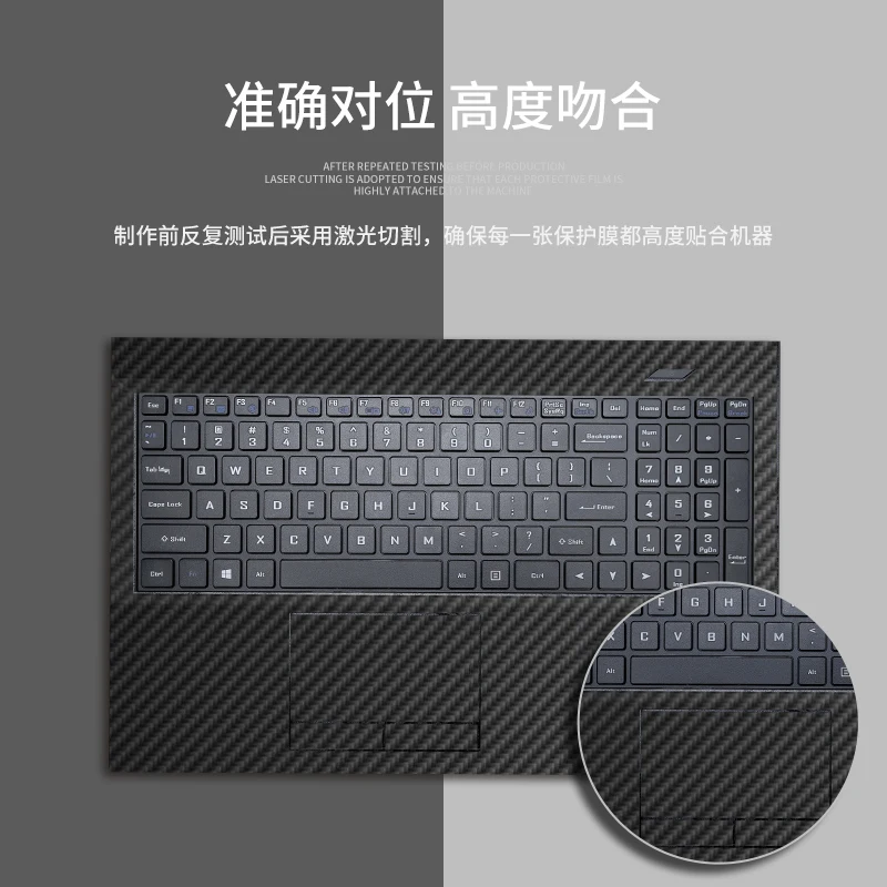 KH Carbon fiber Laptop Sticker Skin Decals Cover Protector for Hasee G8-CT7NK G8-CT7NA 17.3