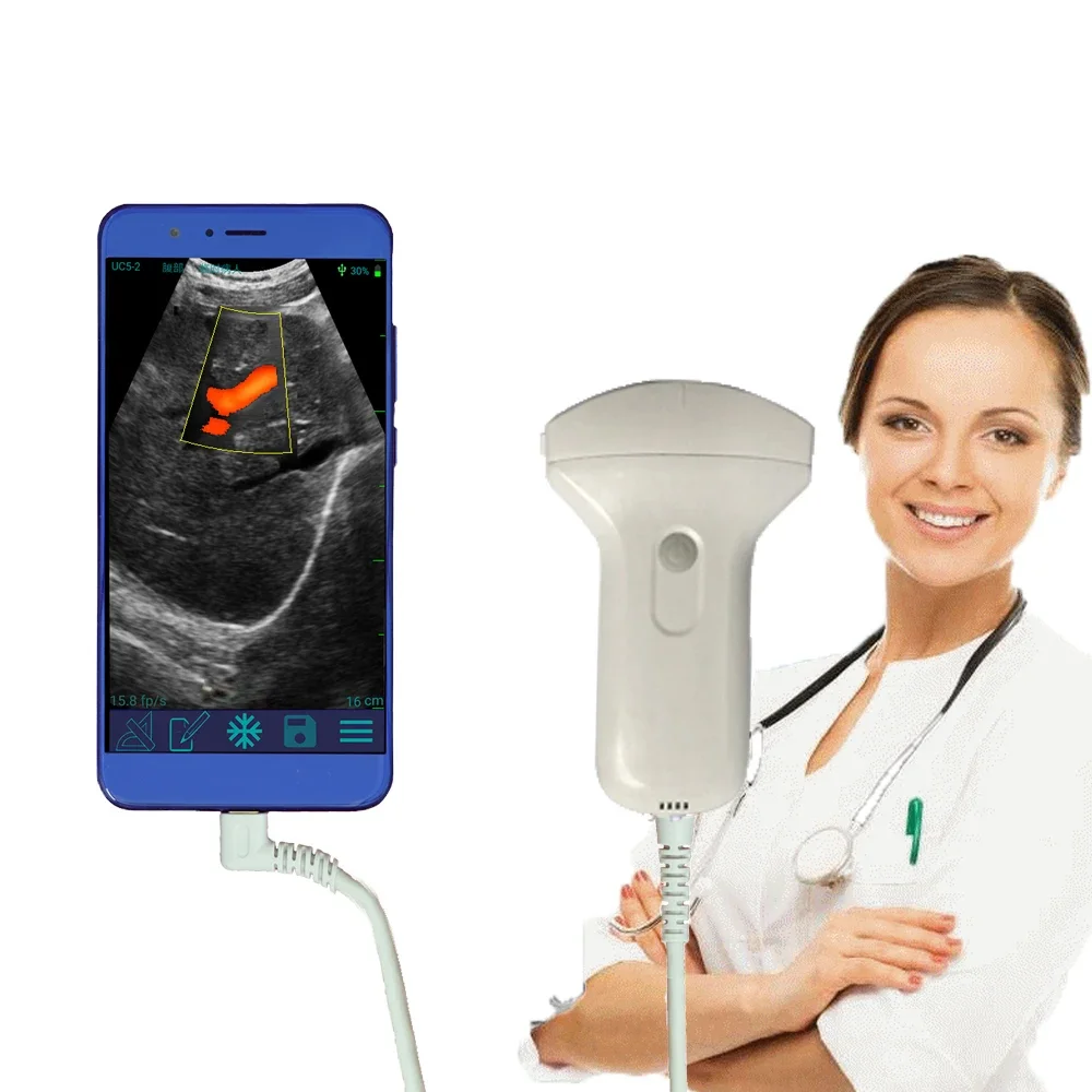 MiniSono portable USB/Wifi color Doppler ultrasound scanner with favorable price.