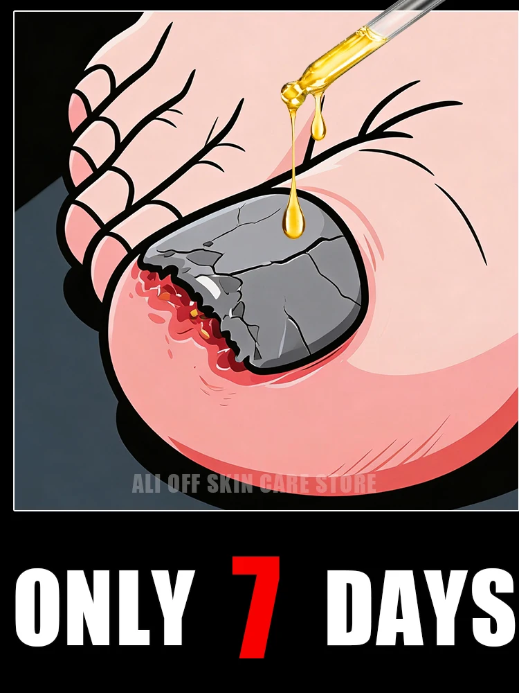 Szybko usuwa grzybienie i przywraca zdrowie paznokci.