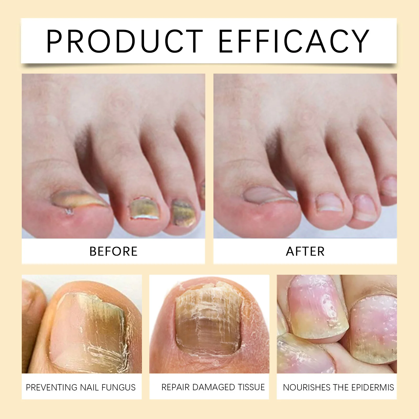 Bee Venom Nagelreparaturserum, 4 ml, Nagelstärkungsbehandlung für geschädigte, spröde Nägel, Wachstumspflege mit Keratin, schnell absorbierend