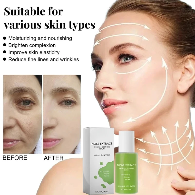 

30ML Noni Fruit Extract Noni Extract Energy Ampoule Facial Essence Anti-Wrinkle Moisturizing Soothing Wrinkle Fine Lines