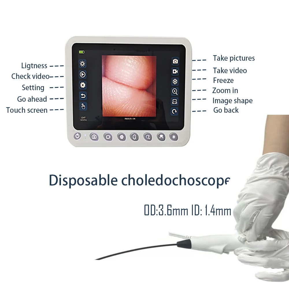 Disposable Low Cost Cholangioscope Providing Clear Biliary Imaging for Duct Checking and Gallstone Extraction Work