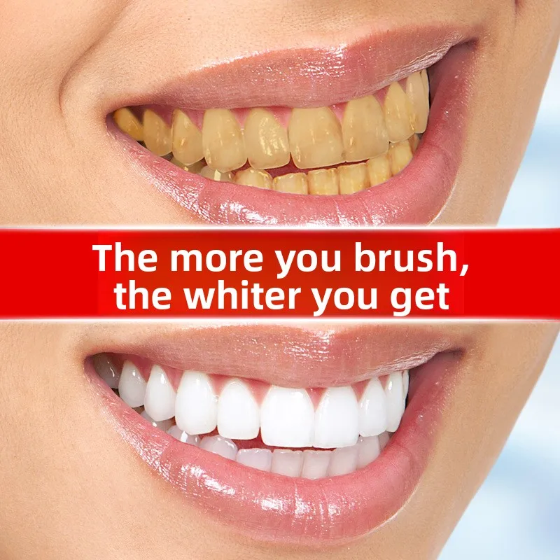 Teeth Whitening Stain Remover Brightening Gel Pen Effective Remove Plaque Stains Oral Teeth Care Pen Teeth Whitening Tools