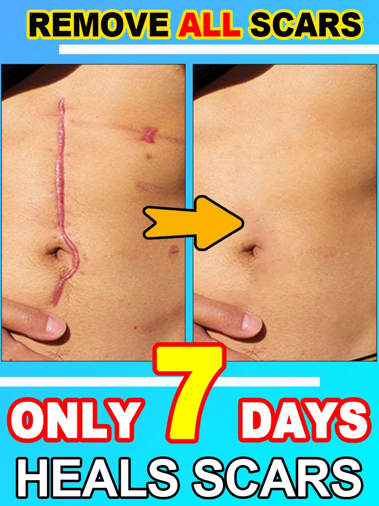 

Кожа гладкая и яркая. Уверите счастливой жизнью