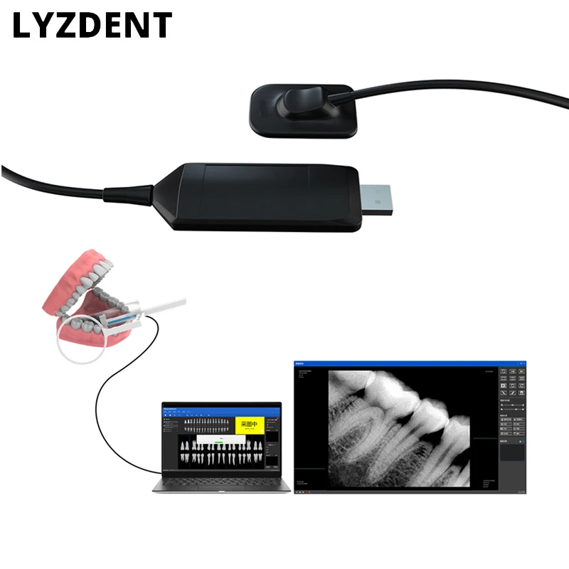 Dentistry Dental Sensor X-Ray High-Frequency Rx Digital Intraoral Digital System H D Image Radiovisografo Dentist Implant Tools