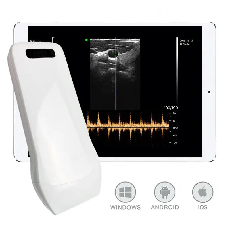 WH-11 Good Quality medical ultrasound instruments portable handheld ultrasound for iphone