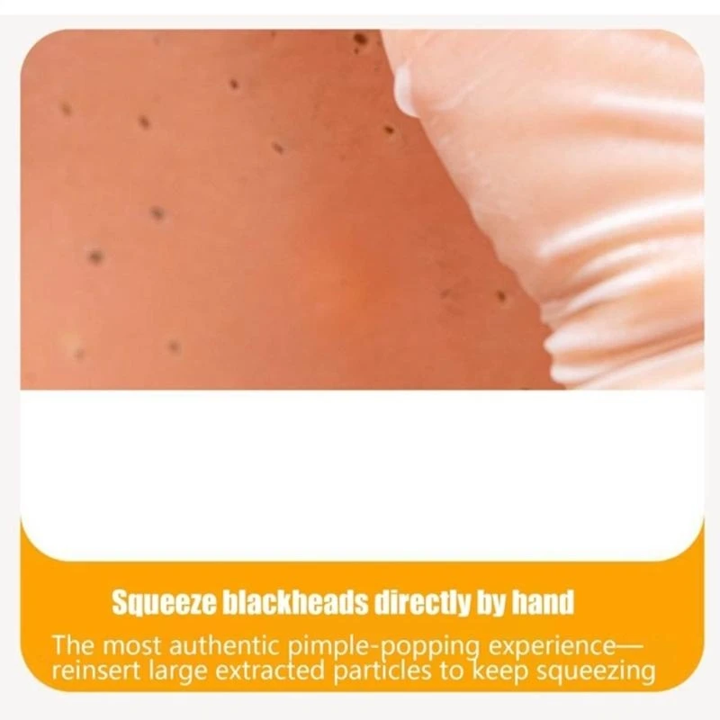 

Realistic Silicone Pimple Popper Stress Relief Toy For Adults Kids Anxiety 15UB