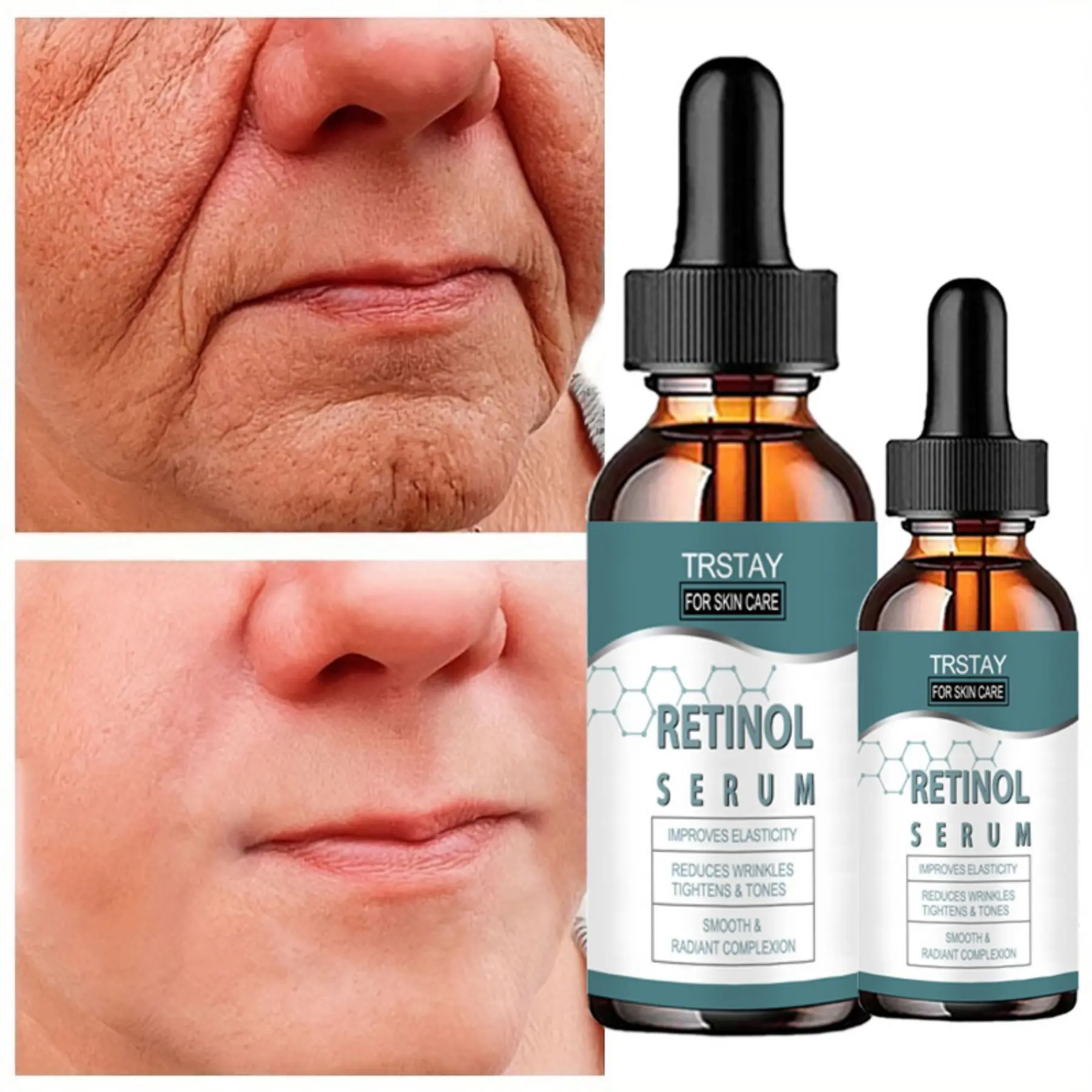 TRSTAY Retinol essence removes wrinkles on your face, leaving you young and beautiful