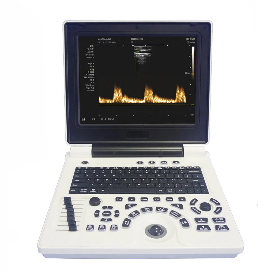 CE Approved Laptop Full Digital Portable 12 inch LCD Display medical ultrasound scan machine