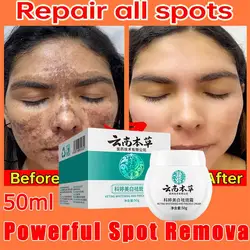 Dark Spot Corrector for Skin Whitening, Fade Cream, Lighten Blemish Removal Serum, Reduz Sardas, Melasma, Sun Spot, Brighten Skin Care