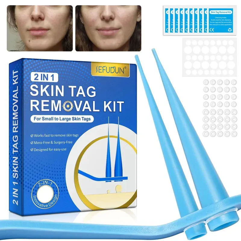 2 In 1 Auto Skin Tag Remover Kit Painless Mole Wart Removal Tool 2-9mm Micro Treatment Skin Care Equipment 2