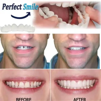 Simulation Denture Upper /Lower Teeth Set with Box Orthodontic Braces Silicone Whitening Teeth Cover Teeth Braces