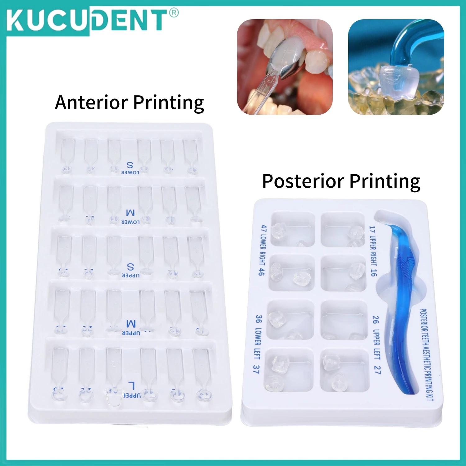 Dental Veneer Mould Kit Posterior Teeth Aesthetic Printing Beauty Veneers for Light Cure Composite Restoration Filling Tools