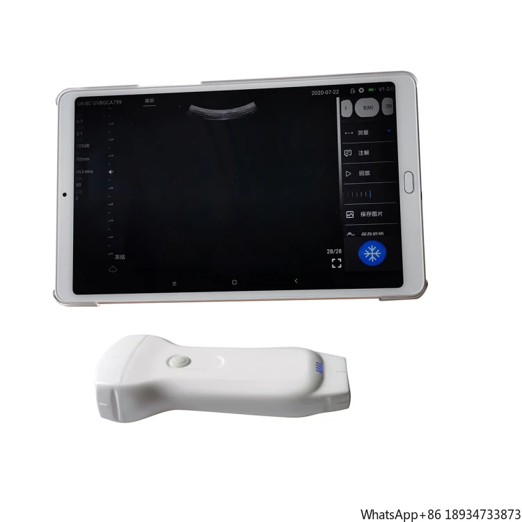 Popular MSLPU80 Highest Cost-effective Double Probes Wireless Color Doppler Ultrasound Scanner