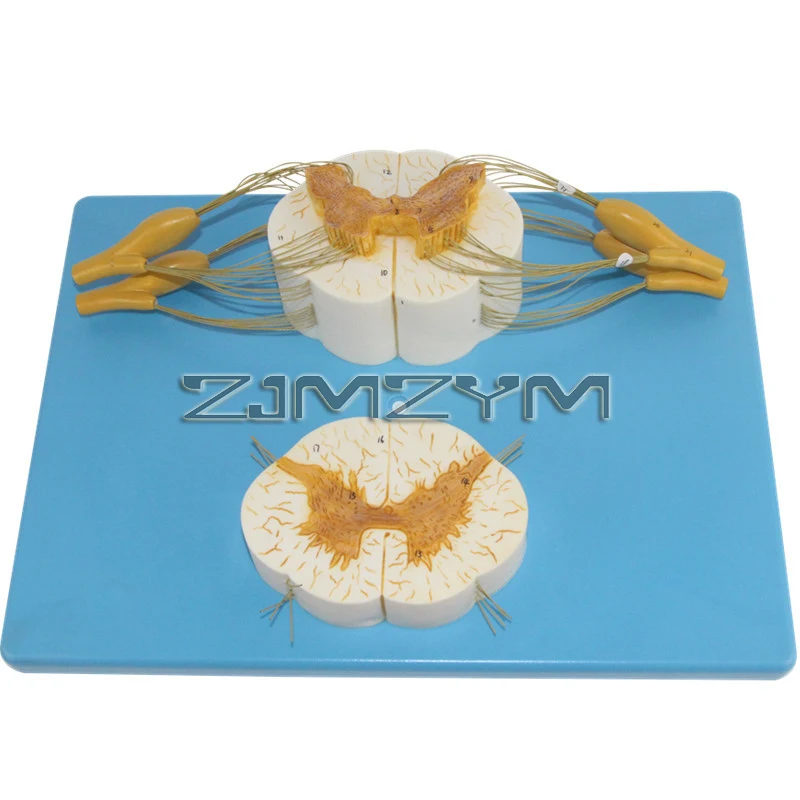 نموذج تشريحي للعمود الفقري البشري الموسع 5 مرات مع حبل العمود الفقري العصبي مع فروع الأعصاب وسائل طبية #2