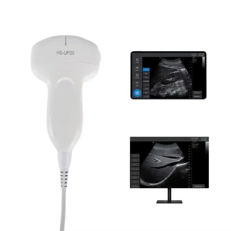 perfect 2026Medical Portable Black & White Ultrasound System USB Convex Array Handheld Probe Ultrasound Machine
