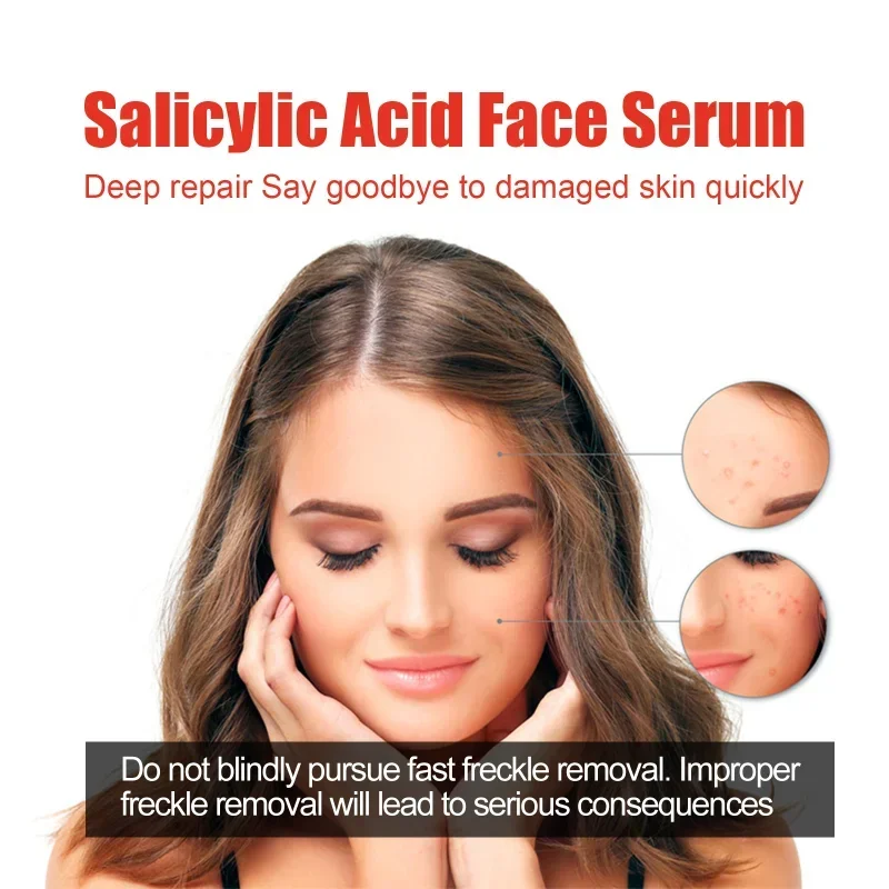 Salicylic Acid whitening freckle Face Serum Fades Dark Spots Remove Melasma Shrinks Pores, Moisturizing Facial Essence Skin Care