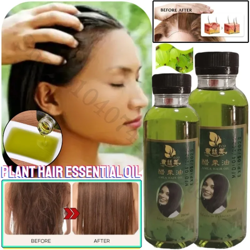 

Indian ALMA Gooseberry Oil Hair Oil Repairs and Nourishes Damaged Hair 100ml