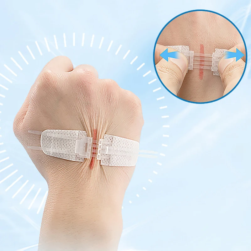 1Pcs Zipper Tie Wound Closure Patch Portable Fast Suture Hemostatic Patch Elastic Bandage Outdoor First Aid Tool Skin Care
