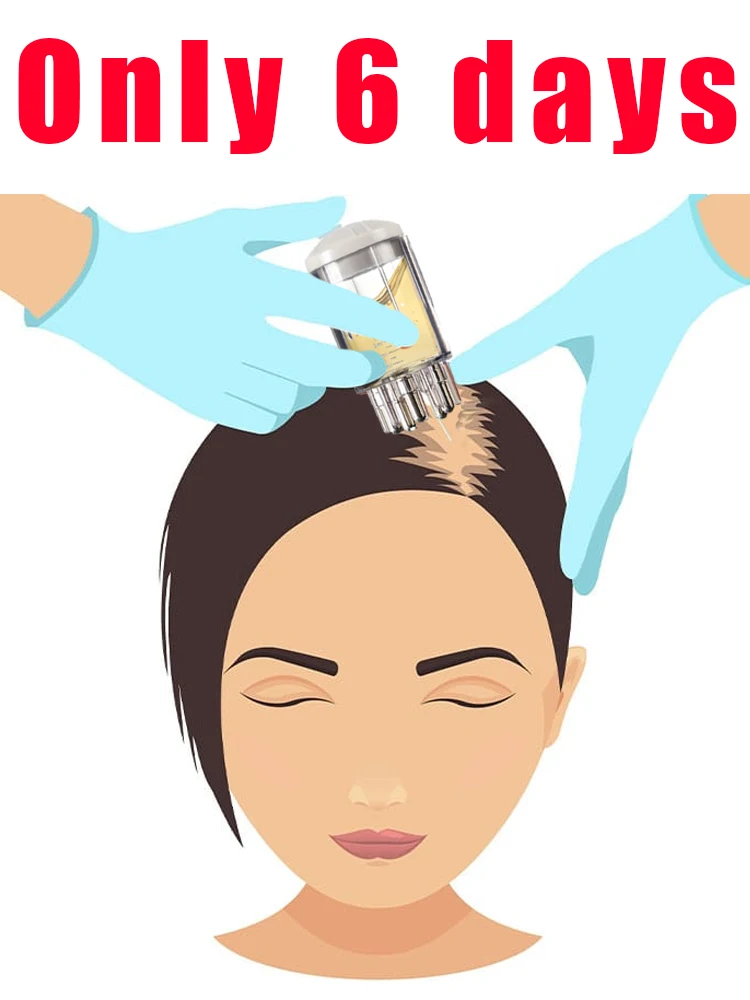 أداة تجديد بصيلات الشعر ذات تصنيف عالي، شحن مجاني #1