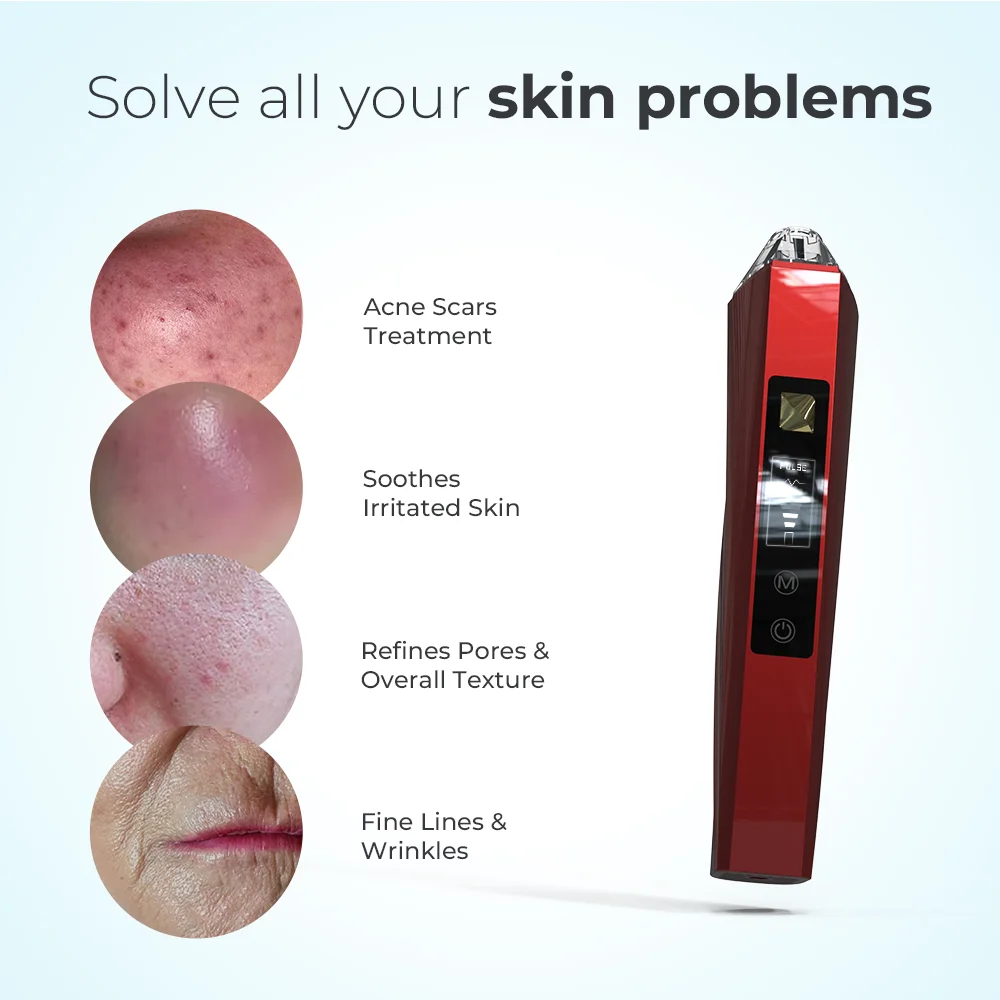 โลก # ปากกาพลาสมาเย็นสำหรับยกกระชับใบหน้าและลำคอ 1 เครื่อง สำหรับใช้ในร้านเสริมสวย/คลินิก ยี่ห้อ Leaflife อุปกรณ์ความงามนวัตกรรมใหม่สำหรับใช้ในบ้าน ช่วยลดเลือนริ้วรอย