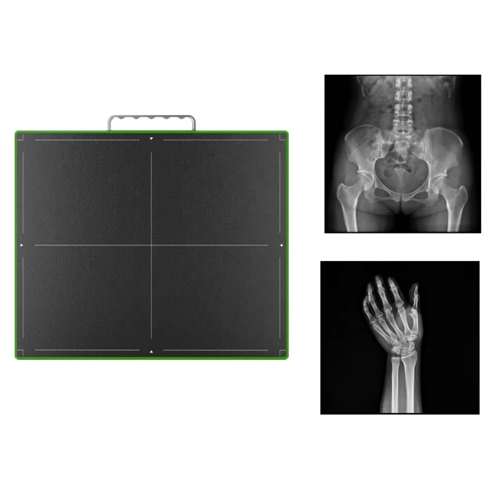 Flat Panel Detector X-ray Machine /Digital Radiography Diagnostic Xray Flat Panel Detector