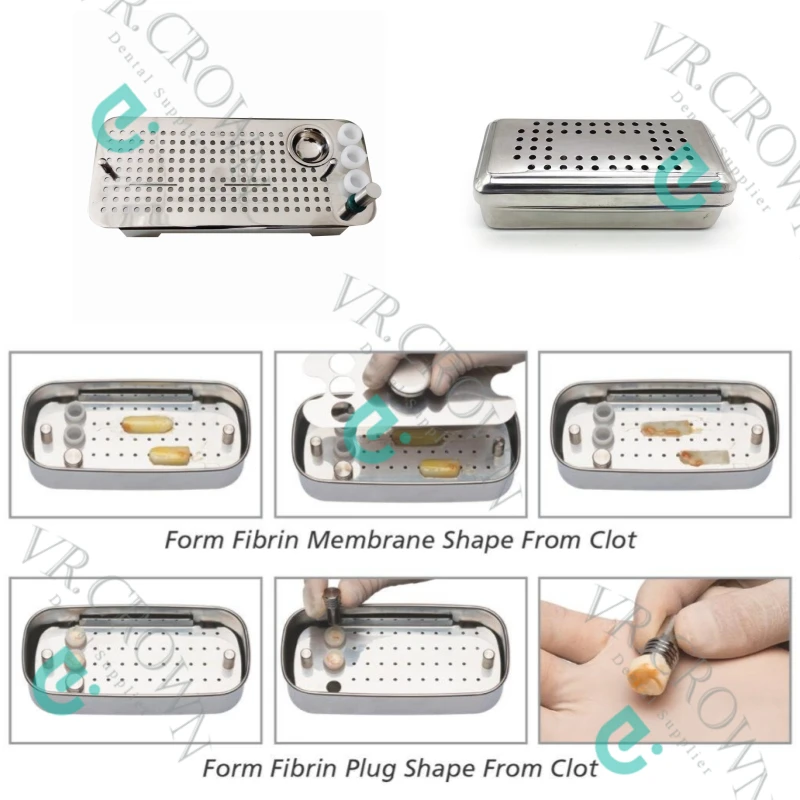 Placa de sistema PRF Box GRF, juego de fibrina rica, Kit de membrana de cirugía de implante Dental con Cassette organizador PRF