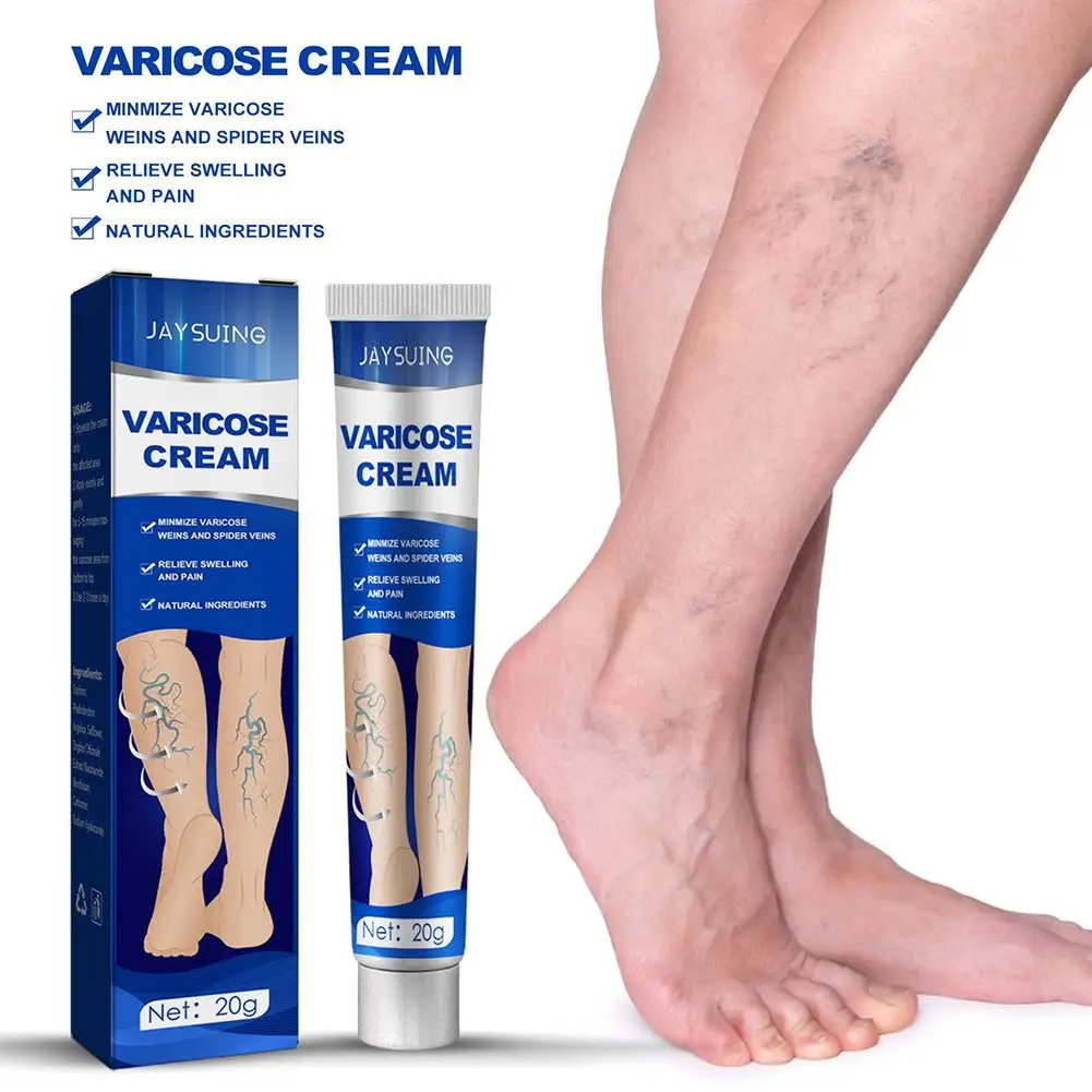 ointment for varicose veins Effective varicose vein relief cream to relieve Leg vasculitis phlebitis spider pain treatment L8P1